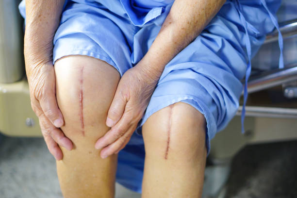 best knee replacement surgeon in andheri